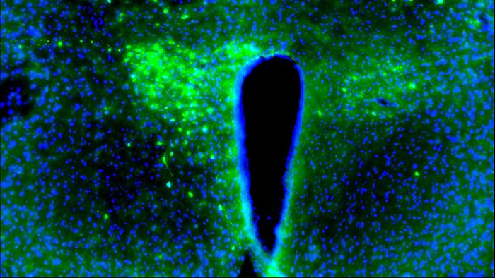 Paraventricular nucleus