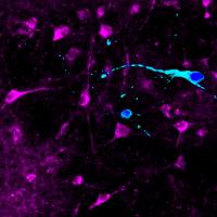 Two Types of iPSC-Derived Hypothalamic Neurons (2 of 2)
