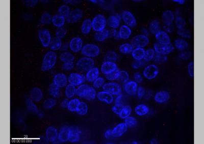 NIST, NCI, SAIC Partner on New Method for Detecting HER2 Breast Cancer (2 of 2)