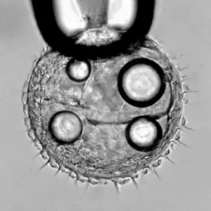 Cilia moving under microscope