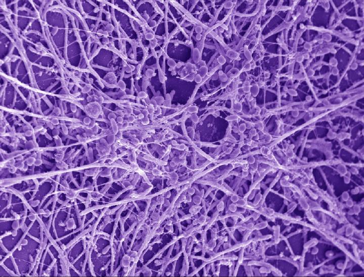 <i>Candida albicans</i> Biofilm
