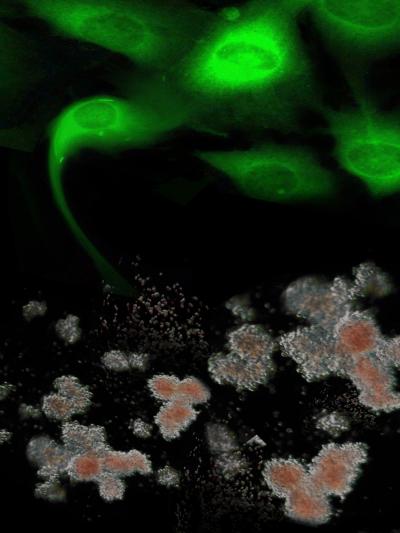 Combined Stem Cell-Gene Therapy Approach Cures Human Fenetic Disease In Vitro