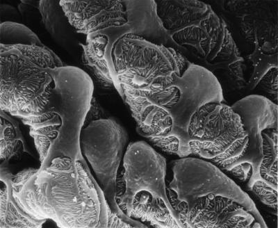 Podocytes