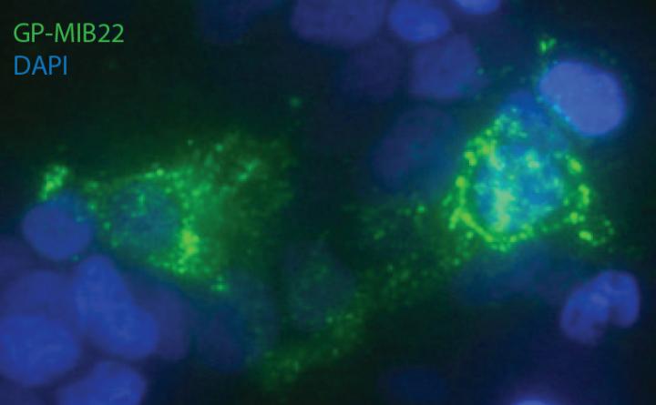 Antibodies from Human Survivors of Andes Hantavirus Protect Rodents Against Infection (1 of 1)