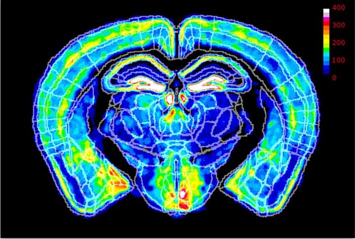X chromosome inactivation in mouse brain