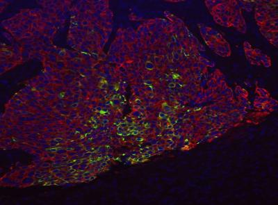 Basal-Like Breast Cancer Cells