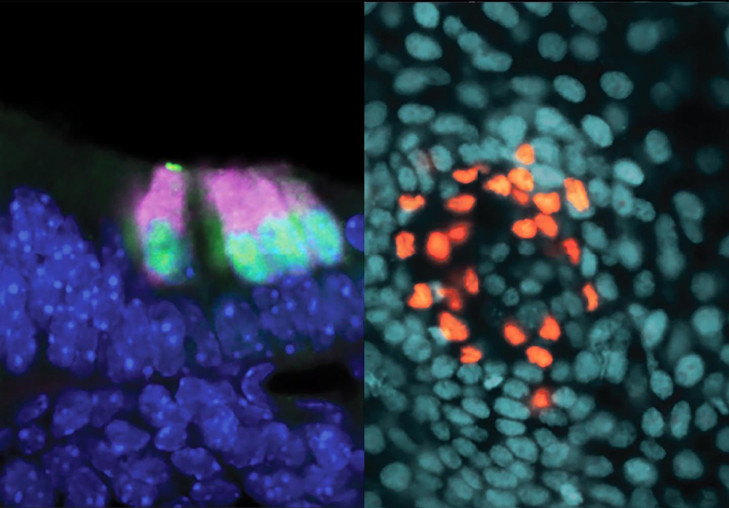 Cells involved in hearing and touch