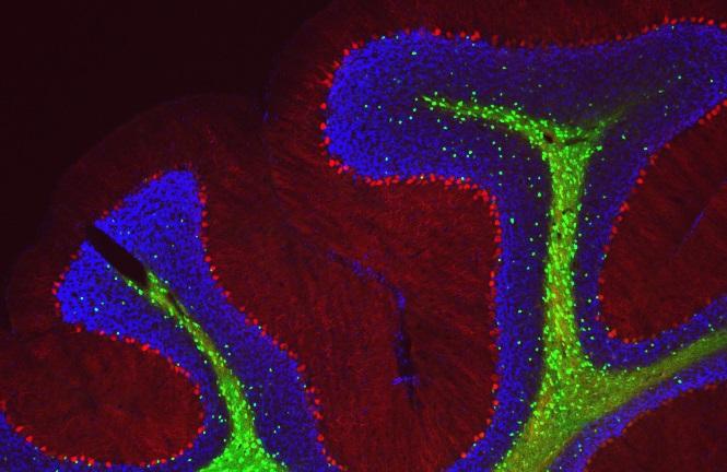 Cerebellar