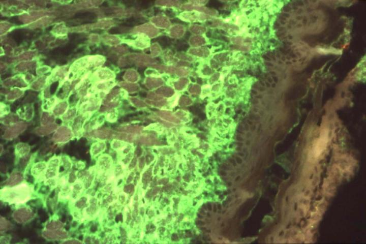 Alphavirus Antigen