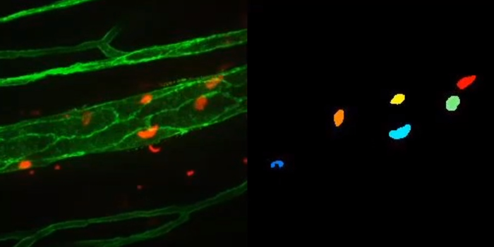 Neutrophil segmentation using the proposed system with ACME software.