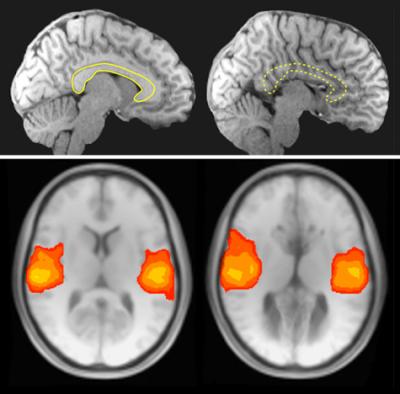 AgCC Brain Activity