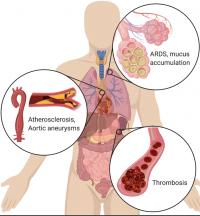 NETs  Body Diagram