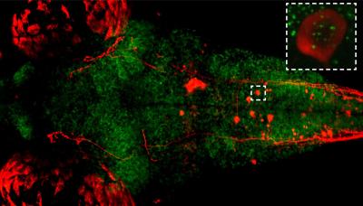 Sleep Tight! Researchers Identify the Beneficial Role of Sleep (1 of 3)