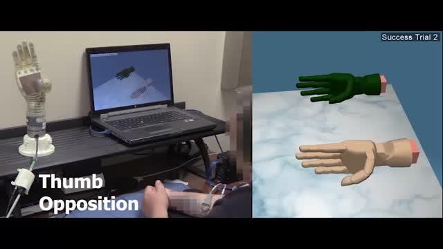 Regenerative Nerve Interface Enhances Precision and Durability of Hand Prostheses (9 of 12)