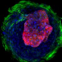 Cardiac Microchambers
