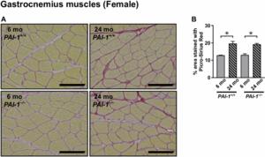 Roles of plasminogen activator inhibitor-1 in aging-related muscle and bone loss in mice