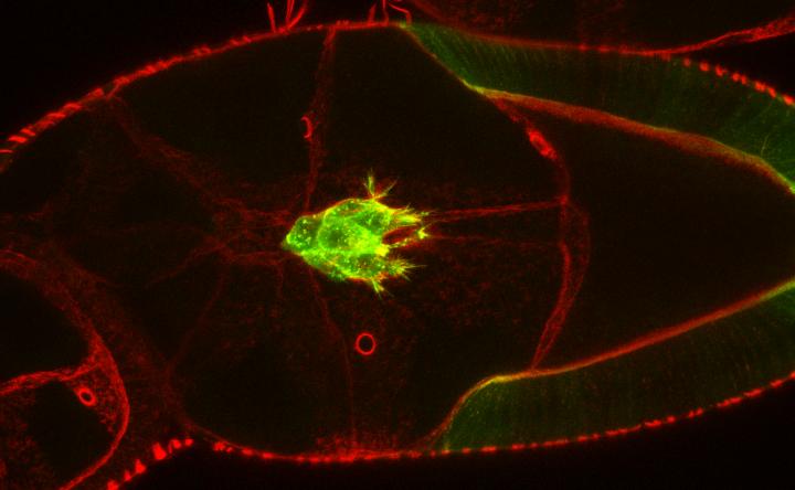 Fruit Fly Border Cells (1 of 2)