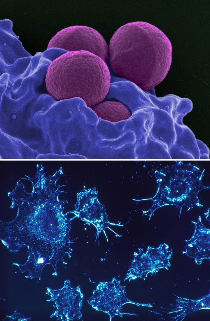 How Best to Treat Infections and Tumors