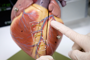 A microfluidic 3D model of the human blood vessel has been developed by NTU and TTSH