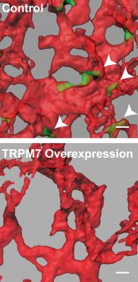 TRPM7 versus control