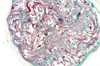 A Stained Section of the Cryogel
