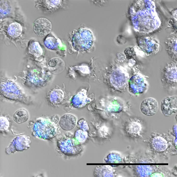 Nanoparticles