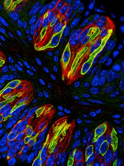 Energy Molecule Transmits 3 Types of Taste to the Brain