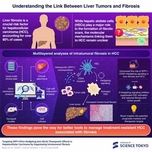 Understanding the Link Between Liver Tumors and Fibrosis