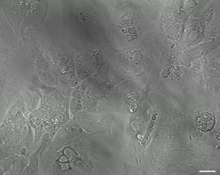 Mouse Heart Cells on Graphene