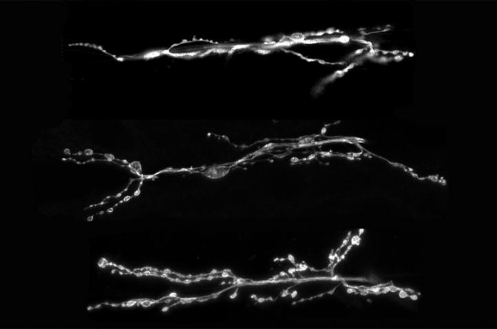 Synapses
