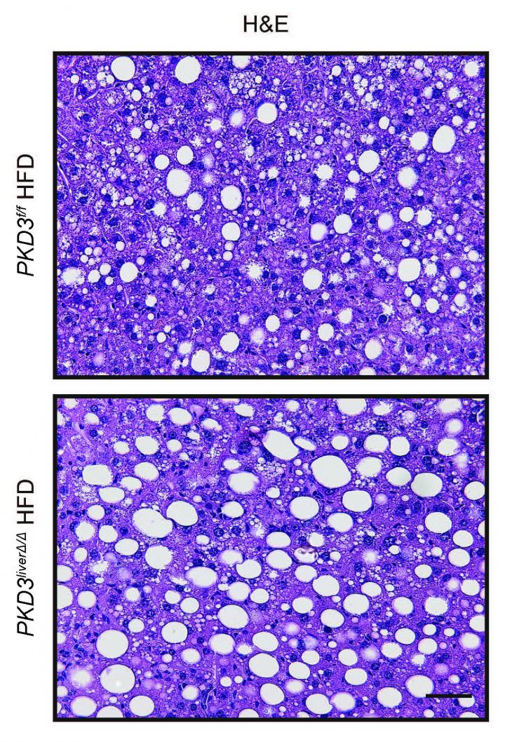 Negative Feedback Mechanism Keeps Liver Fat in Check (1 of 1)