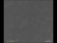 Movie: Kidney Organoid and Cyst Formation