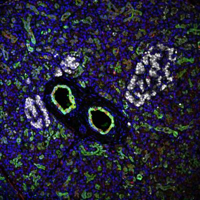 Pancreatic Progenitors with the Potential to Regenerate Reside in Ductal Network