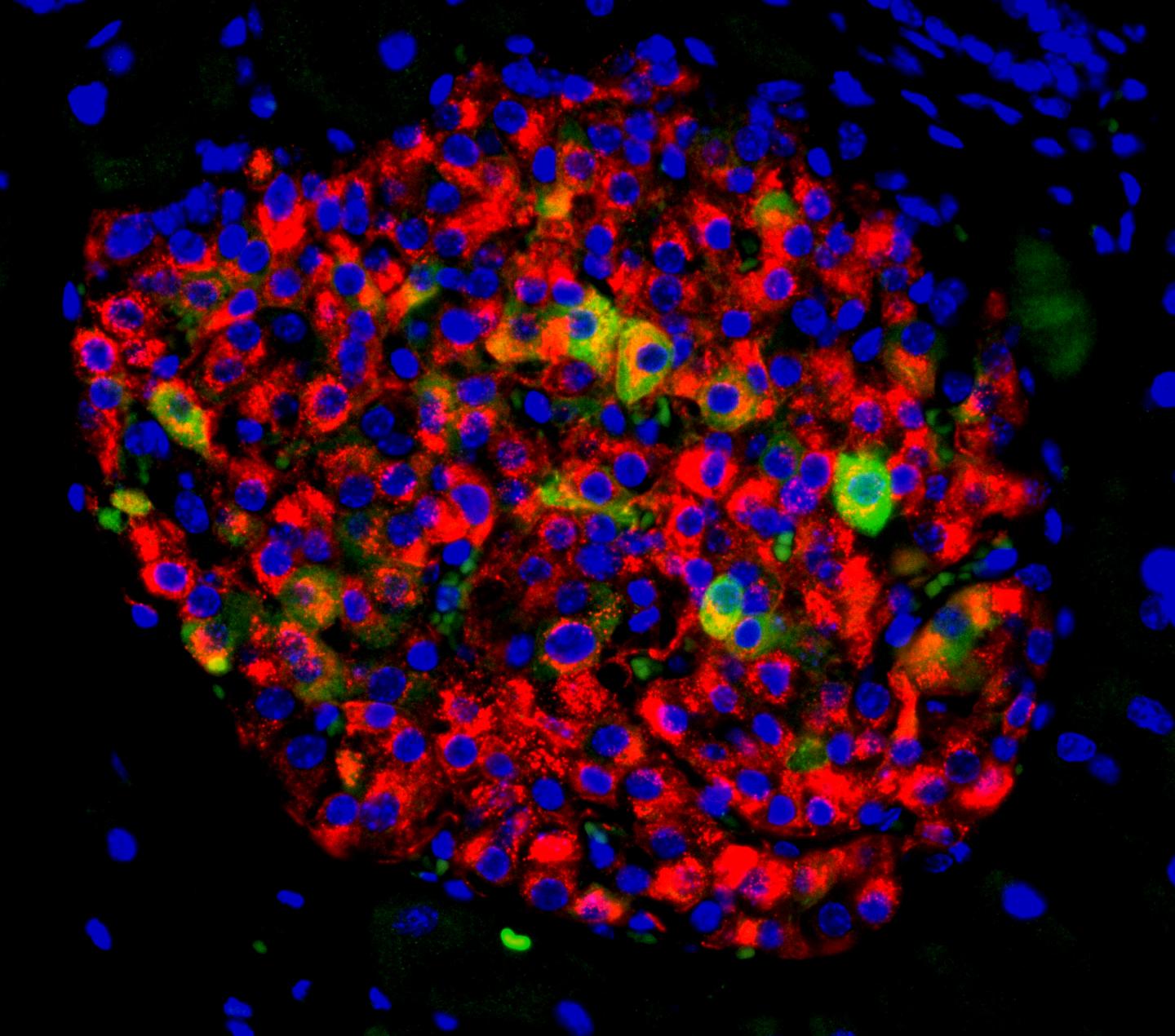 Pancreatic Islet with Insulin-Producing Beta Cells and Beta Cells Showing Signs of Failure