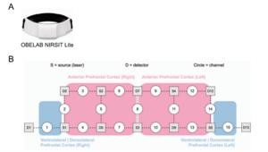 Same “Depressed” Body Movements, Opposite Brain Responses: KAIST Study Reveals Differences by Depressive Symptom Level