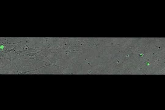 Subplate Neurons