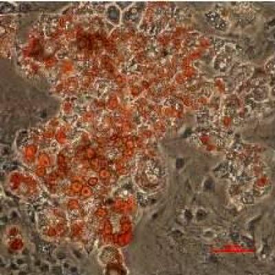 Fat Cells