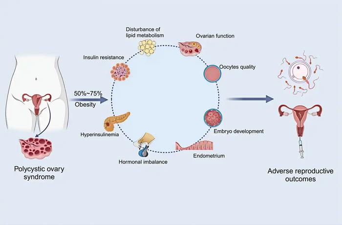 Potential mechanisms linking obesity to adverse reproductive outcomes in infertile patients with PCOS.