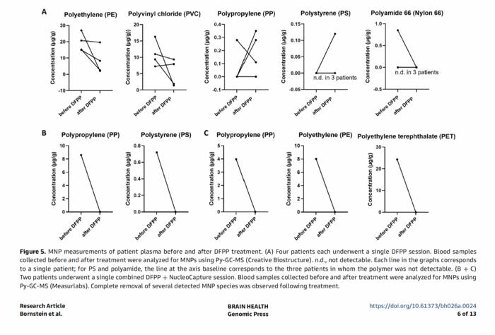Micro- and nanoplastics (MNPs) measurements of patient plasma before and after double-filtration plasmapheresis (DFPP) treatment
