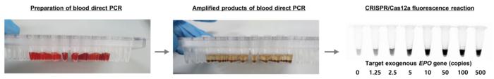 [Figure 3] The actual process of blood direct PCR and an example of when they are detected and visually confirmed.