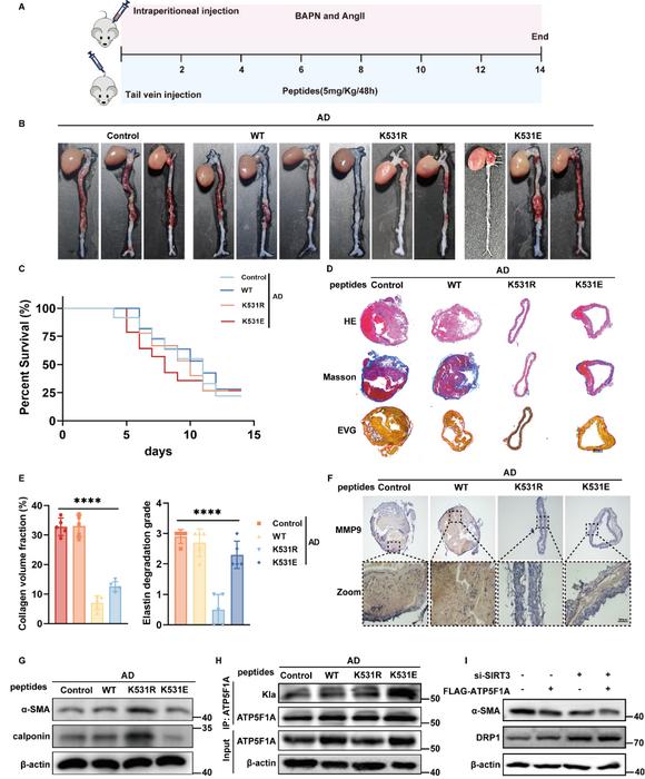 Figure 3. Lactylation of ATP5F1A at K531 is involved in the progression of aortic dissection