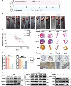 Figure 3. Lactylation of ATP5F1A at K531 is involved in the progression of aortic dissection