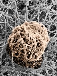 T Cell Squeezes Through Blood Vessel Wall 2