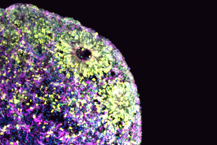Brain organoid