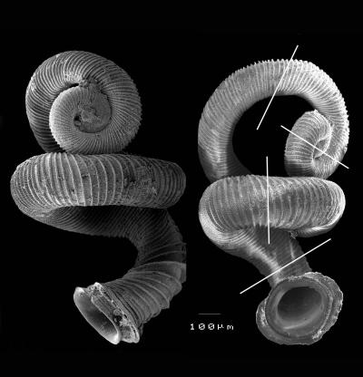 Whorly Snail