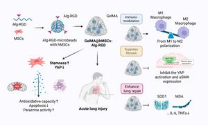 Schematic illustration of the preparation of GelMA@hMSCs-Alg-RGD and its therapeutic application in lung injury.