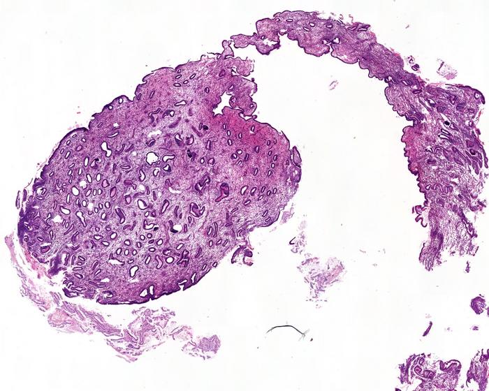 A hystological image of uterus lining