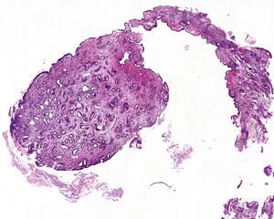 A hystological image of uterus lining