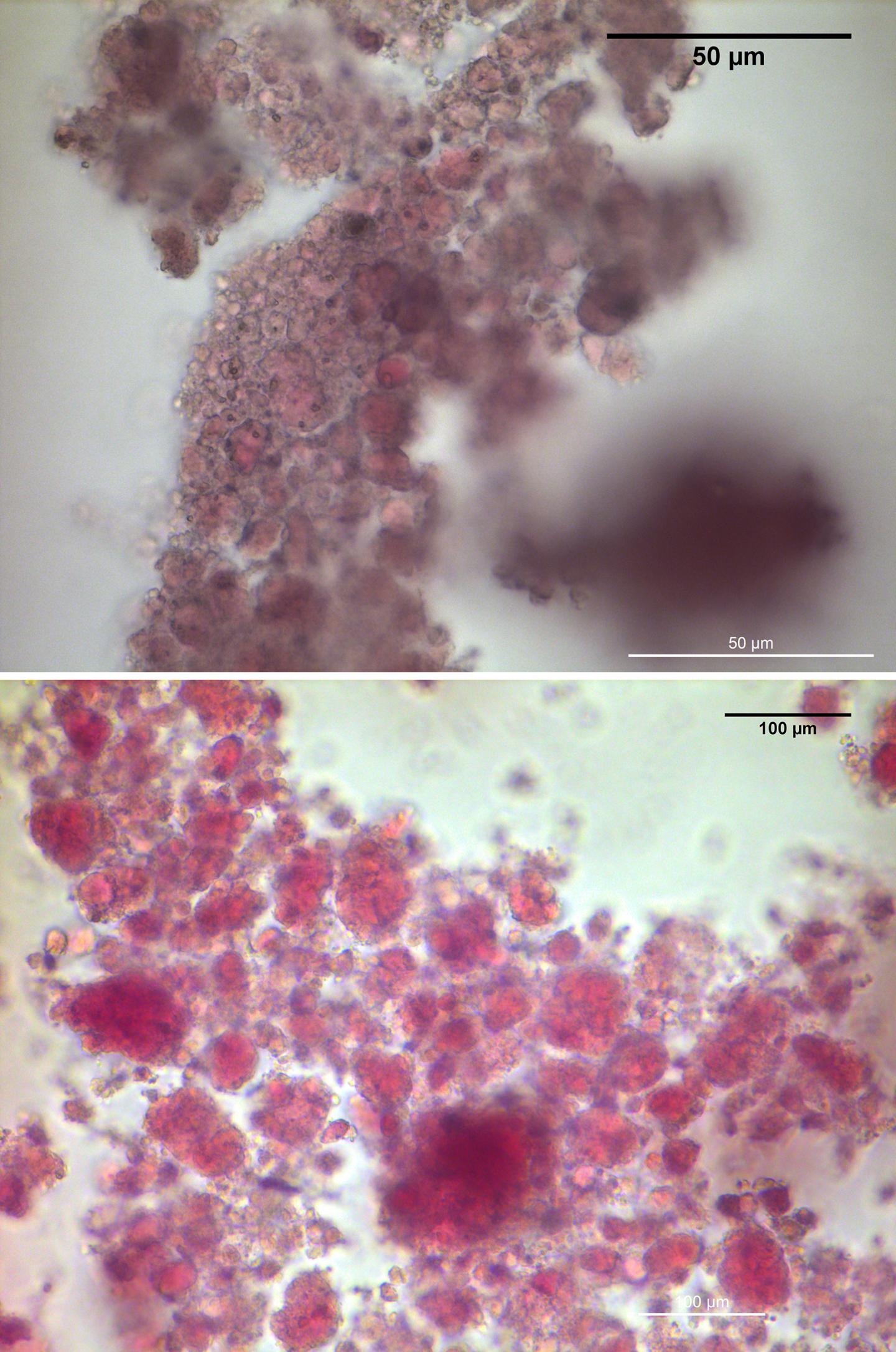 Nanoparticles Before and After