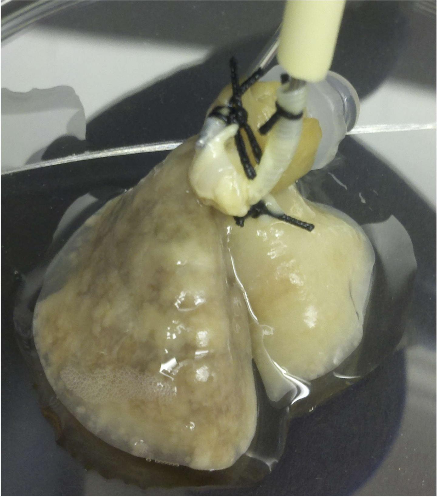 4-D Cancer Model